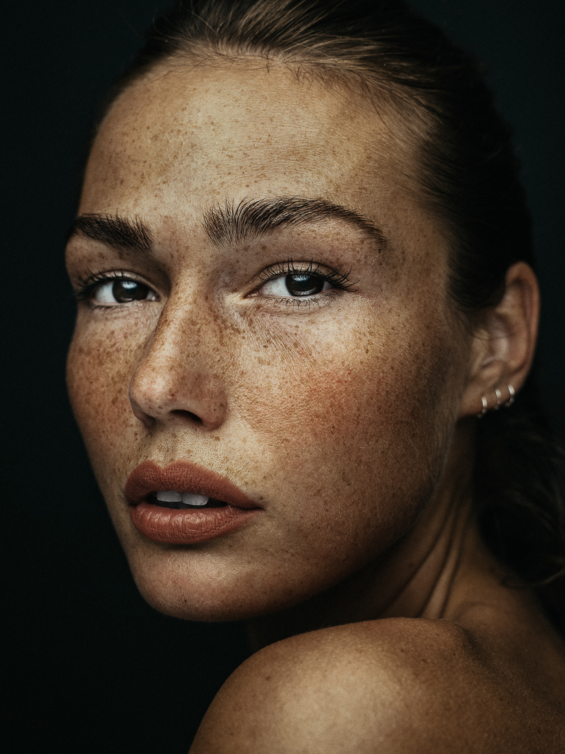 Freckles beauty