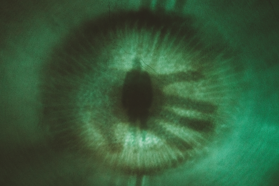 Eye