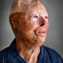 The Outside of the Inside